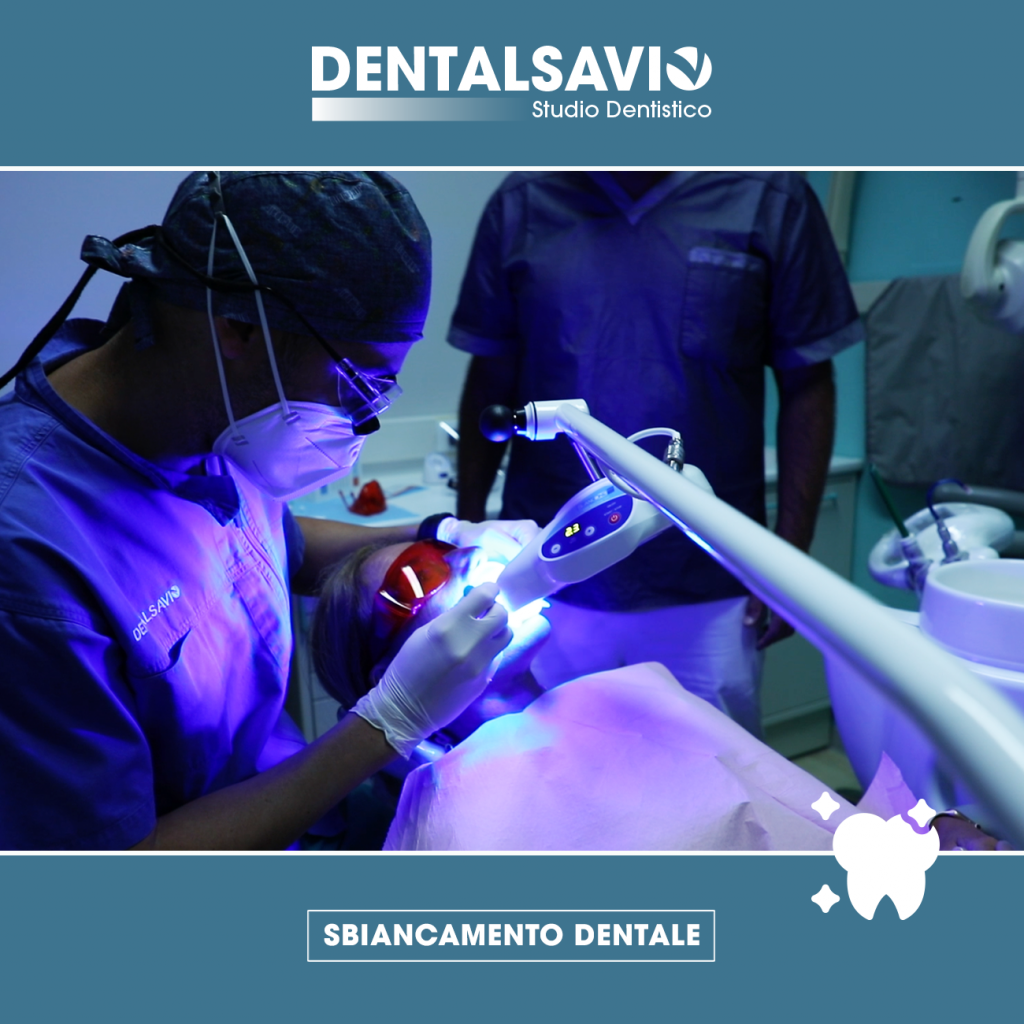 sbiancamento dentale dentalsavio