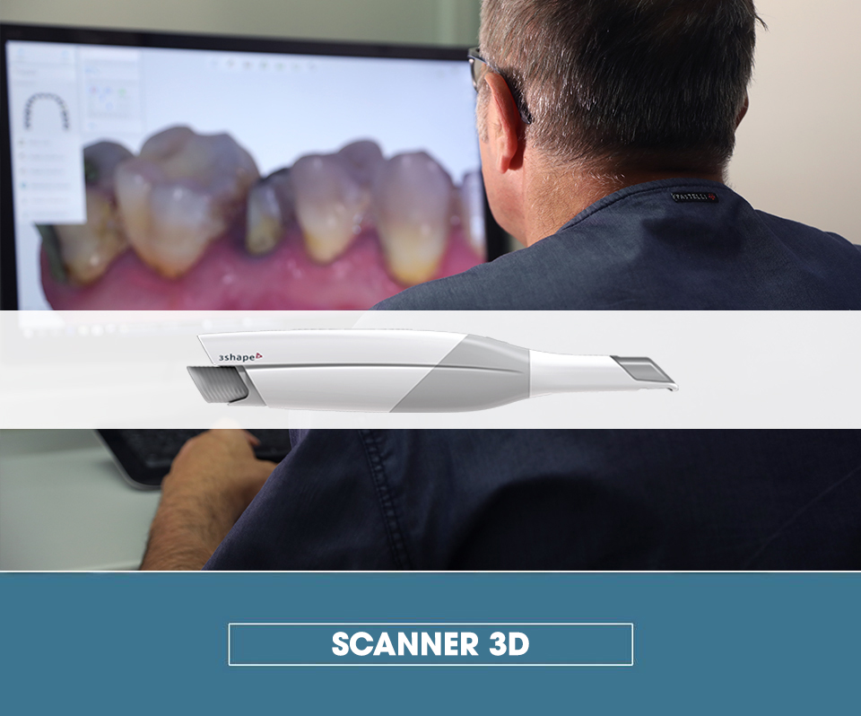 scanner 3d